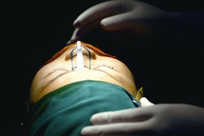西安小伙隆鼻后鼻子歪斜呼吸困难 协商未果卫健局已介入