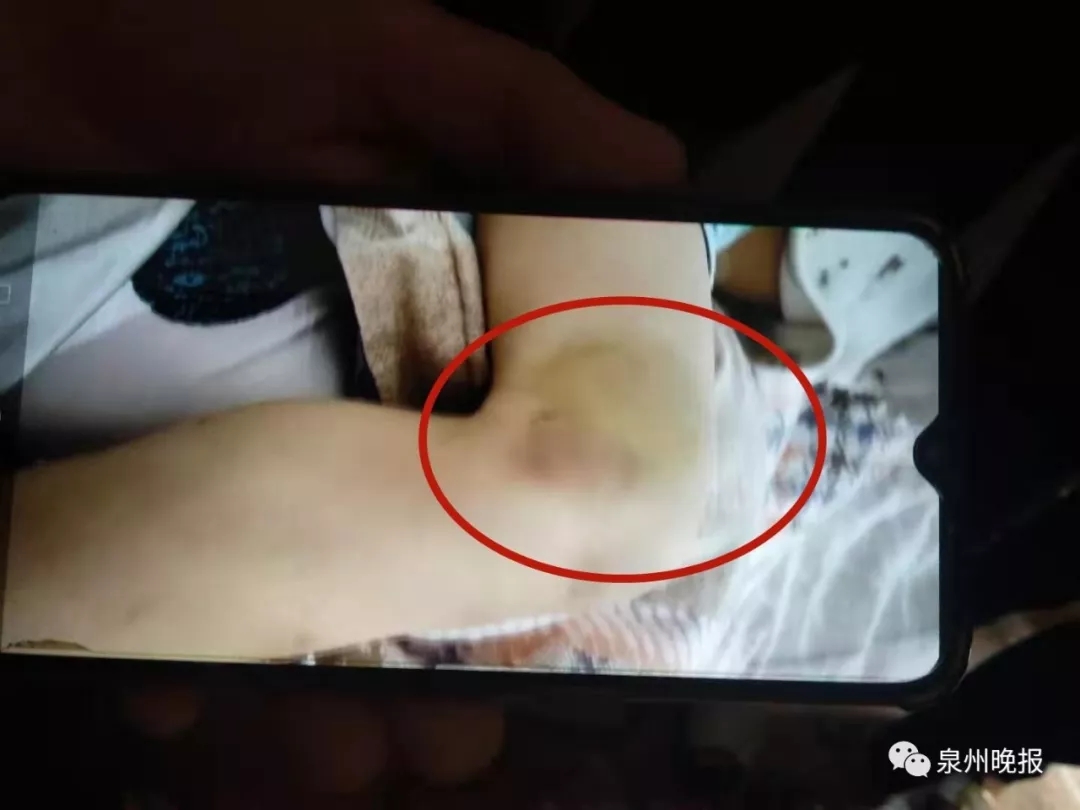禽獸不如！福建惠安5歲男孩被后媽虐打致死 嫌疑人已被刑拘