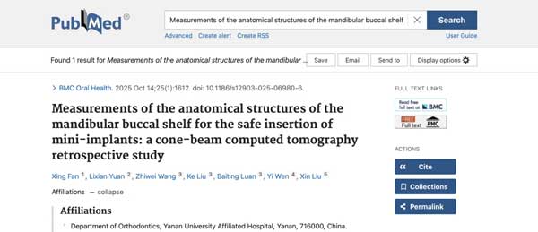 延大附院口腔正畸科发表SCI论文
